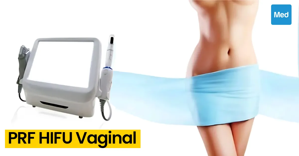 PRF HIFU Vaginal : La Nouvelle Génération de Traitements Gynécologiques